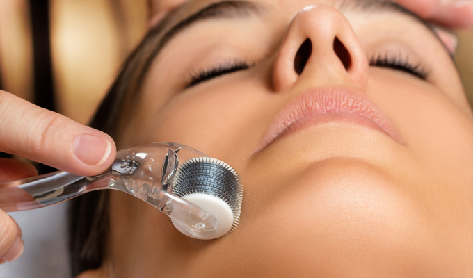 Descubrimos los beneficios del rodillo de micro agujas o skinroller - Imagen: iStock