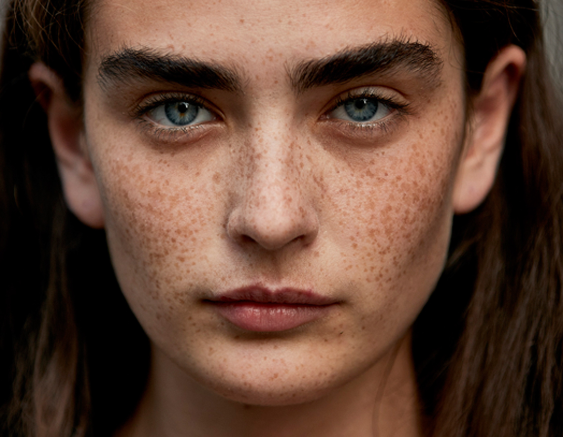 Belleza en verano: cómo cuidar la piel con pecas