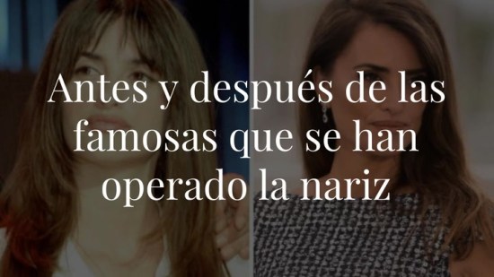 El antes y el después de las famosas que se han operado la nariz