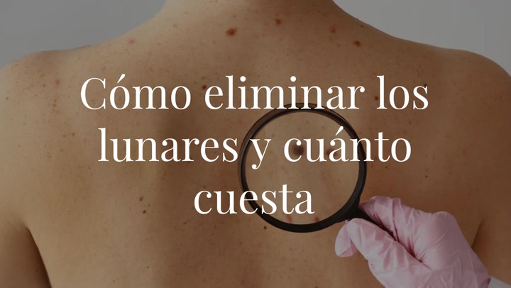 ¿Cómo eliminar los lunares y cuánto cuesta?