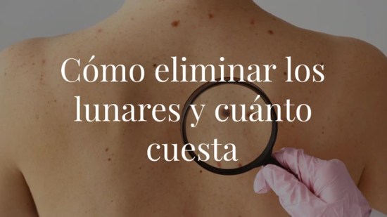¿Cómo eliminar los lunares y cuánto cuesta?