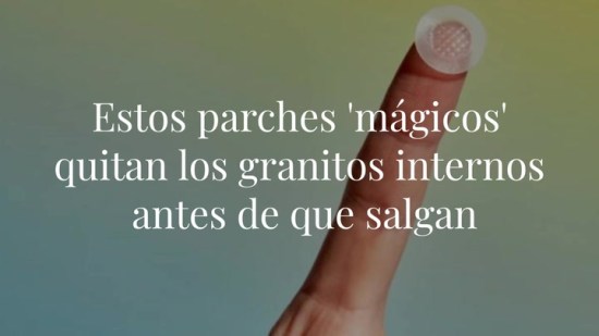 Estos parches 'mágicos' quitan los granitos internos antes de que salgan