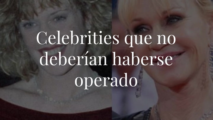 Celebrities que no deberían haberse operado