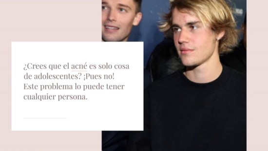 Famosas con acné y los trucos para acabar con los granos