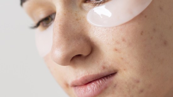 cerrar-mujer-parches-ojos