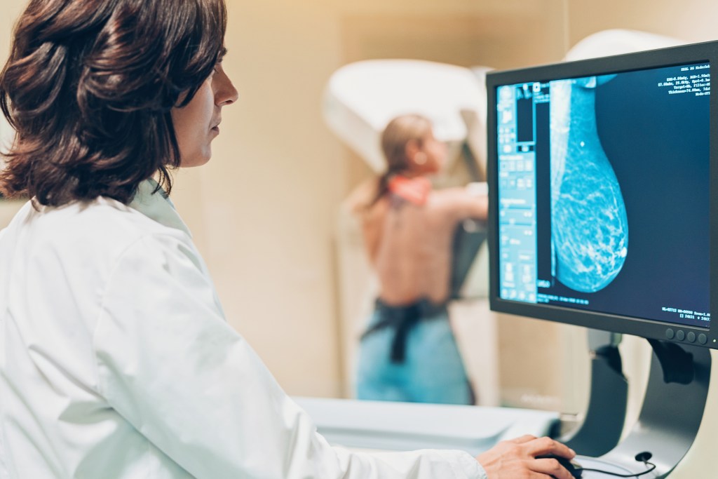 Mamografía - iStock