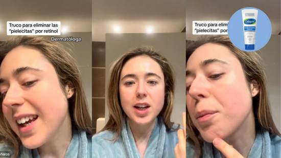 gran-error-al-usar-retinol-contra-envejecimiento-dermatologa-aconseja
