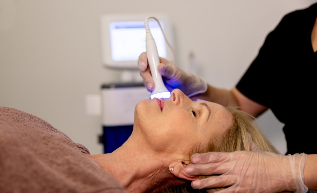 Radiofrecuencia facial